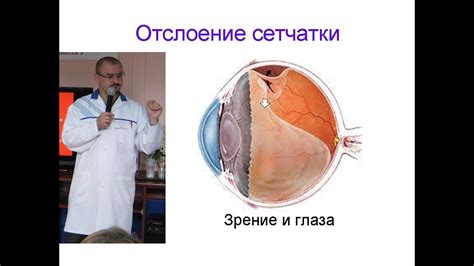 Отслоение сетчатки. Его правильное лечение. - YouTube