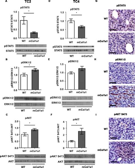 Elevated Collagen I Augments Tumor Progressive Signals Intravasation