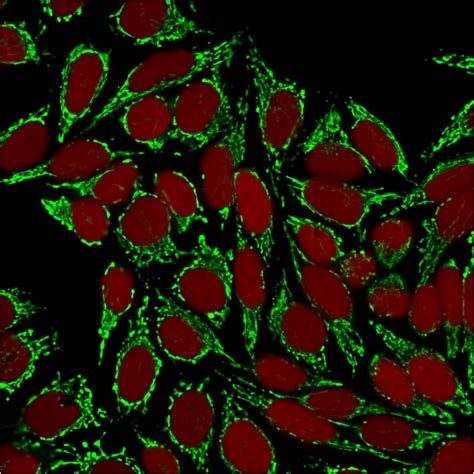 Hsp60 Heat Shock Protein 60 Mitochondrial Marker Antibody Clone