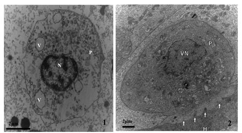 Transmission Electron Micrographs Of Ceratomyxa Aegyptiaca From The