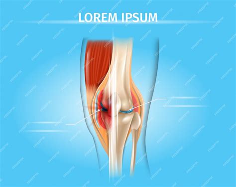 Premium Vector | Knee Pain and Arthritis Treatment Vector Chart