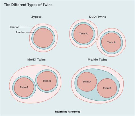 What Is Twin Zygosity Understanding Different Types Of