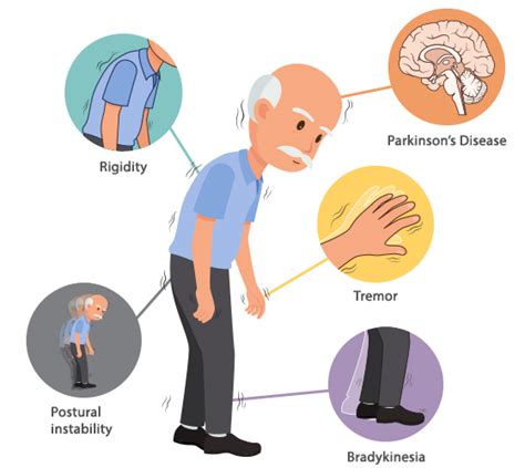 Parkinsons Disease Physiotherapy Centre