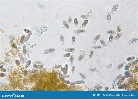 Tetrahymena is a Genus of Unicellular Ciliated Protozoan Stock Image ...