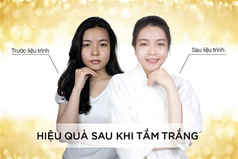 HÌNH ẢNH TRƯỚC VÀ SAU KHI ĐIỀU TRỊ TẮM TRẮNG HT Beauty