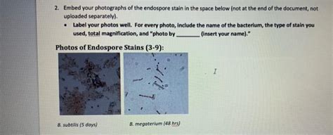 Solved Capsule And Endospore Stain And Points Chegg