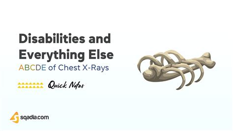 ABCDE of Chest X-Rays | CXR ABCDE | X RAY Interpretation