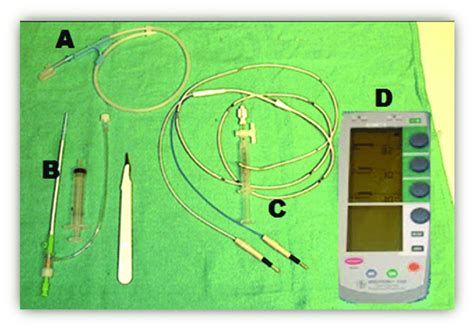 Femoral Transvenous Pacemaker