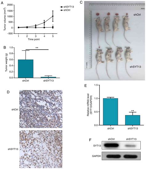 Silencing Of Synaptotagmin Inhibits Tumor Growth Through Suppressing