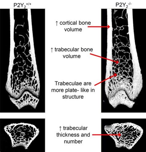 Increased Trabecular And Cortical Bone In P Y Mice Ct Analysis