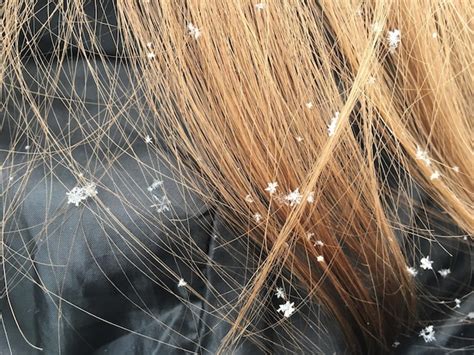 Premium Photo Close Up Of Snowflakes On Woman Hair