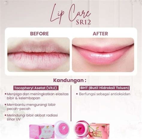 Jual Lipcare Sr12 BEST SELLER LIP GEL LIP BALM PENCERAH WARNA BIBIR