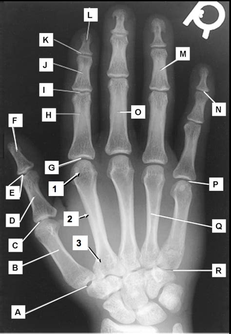 Hand Anatomy Diagram | Quizlet