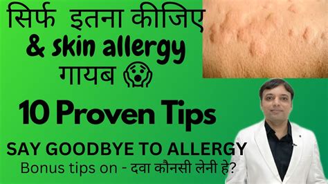 Tips For Skin Allergy Treatment At Home