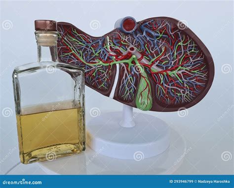 Alcoholic Liver Damage And Liver Cirrhosis Concept With Liver And