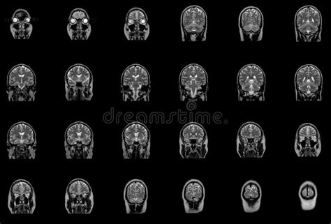 brain stem parts anatomical model  educational labeled outline