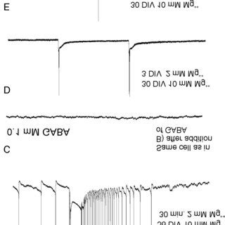 Morphology Of Layer V Pyramidal Cells Ac Neuron Aged Div From