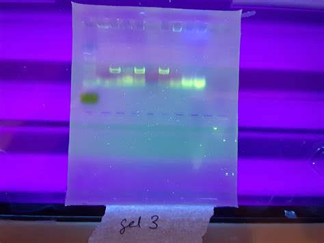 Document Your Agarose Gel Observations With A Picture Chegg