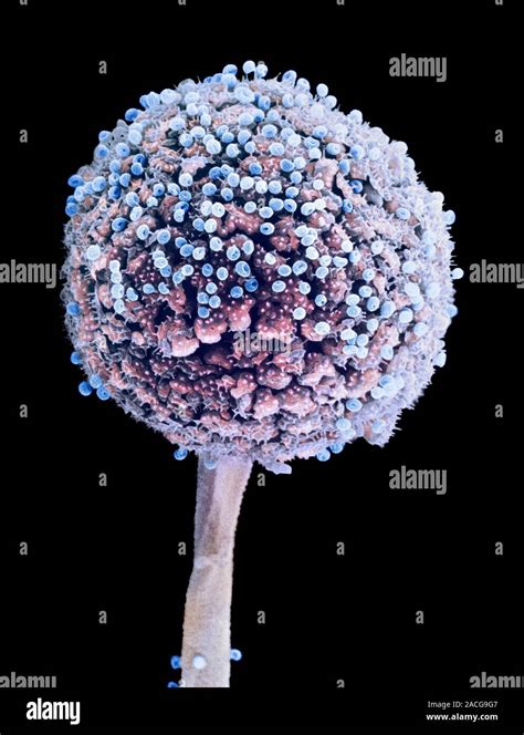 Bread Mould Coloured Scanning Electron Micrograph SEM Of A