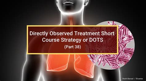 Dots Or Directly Observed Treatment Short Course Strategy Part 38