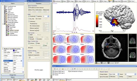 Curry 8 Compumedics Neuroscan