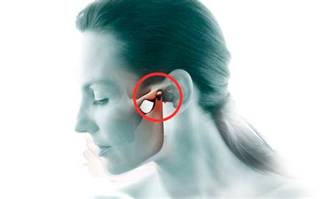 DISFUNCIÓN TEMPOROMANDIBULAR CANTINI FISIOTERAPIA OSTEOPATÍA