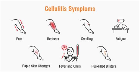 Cellulitis Symptoms Causes Diagnosis And Effective Treatment Options