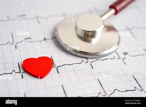 Stéthoscope sur électrocardiogramme ECG avec cœur rouge onde