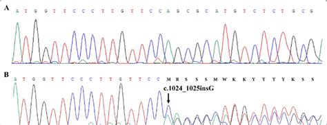 A Partial Dna Sequence Chromatogram Of Exon 9 Of The Mitf Gene Download Scientific Diagram