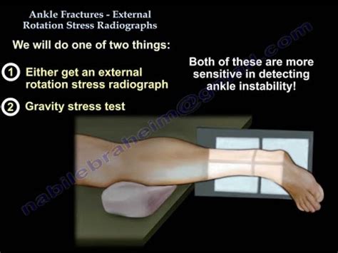 Stress X Ray Ankle