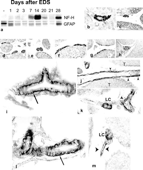 Neural Characteristics Of Leydig Cells And Their Vascular Progenitors