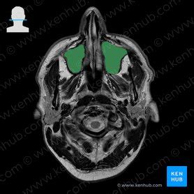 Maxillary sinus: Anatomy and structure | Kenhub