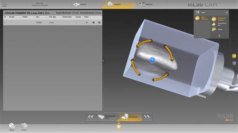 Milling Tibase Crowns To Cerec Mcxl With A Medit Scan And Exocad Design