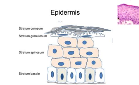 Crusting Scaling And Pigmentary Disorders Flashcards Quizlet