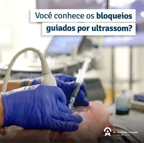 Você Conhece Os Bloqueios Guiados Por Ultrassom Dr Antônio Krieger