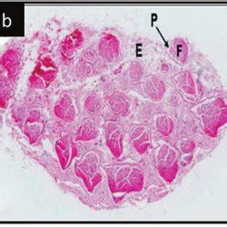 1 Electron and light microscopy image of the nerve fascicle (F) at (a ...