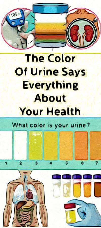 Colon Prep Color Chart