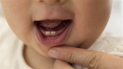 Mal di denti nei bambini le cause più diffuse