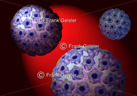 Gebärmutterhalskrebs durch humane Papillomaviren HPV Medical Pictures