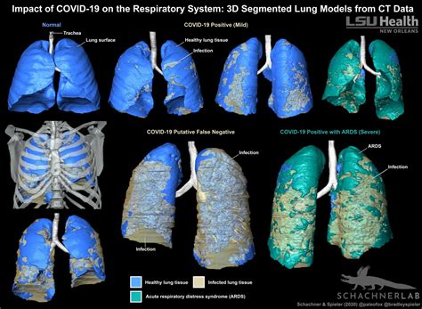 D Segmented Lung Models Of Co Image Eurekalert Science News Releases