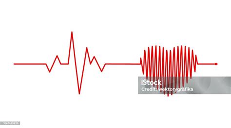 Irama Jantung Elektrokardiogram Ekg Sinyal Ekg Desain Konsep Garis