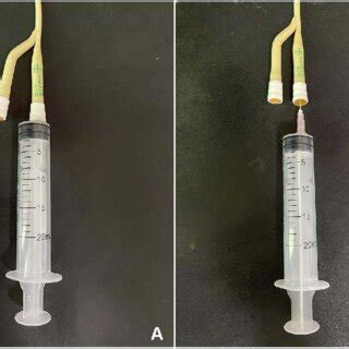 Different Connection Methods Used Between Syringe And Uterus