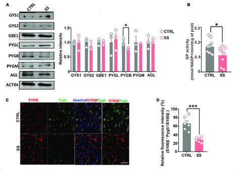 | Expression of key enzymes in glycogenesis and glycogenolysis under ...