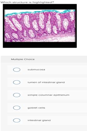 Solved Which Structure Is Highlighted Multiple Choice Submucosa