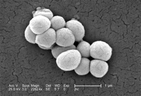 Micrococcus luteus - microbewiki