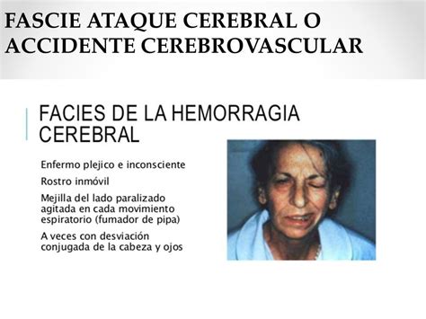 Nervioso Snc Cerebro Cerebrelo PedÚnculos Cerebrales Protuberancia