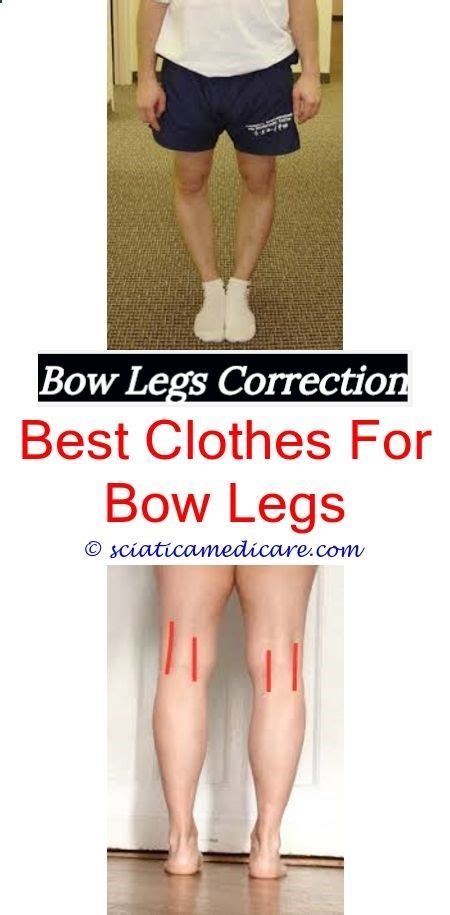 Bow Legged Celebrities - Life Styles