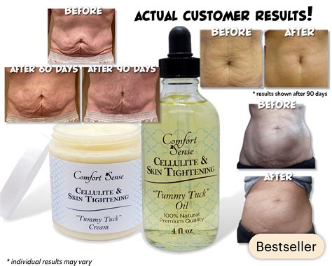 Cellulite & Skin Tightening “Tummy Tuck” Cream & Oil Combo – Comfort Sense