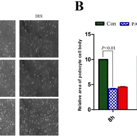 Western Blot Analysis Of P Akt And Akt In The Podocytes From The