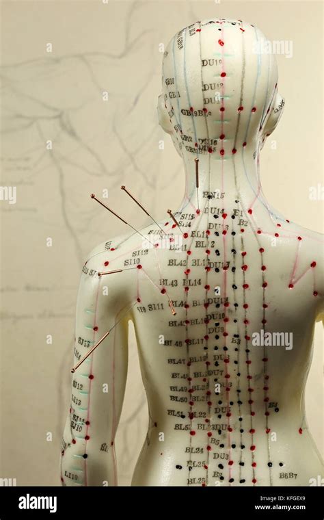 Female Acupuncture Model With Needles In The Shoulder Stock Photo Alamy